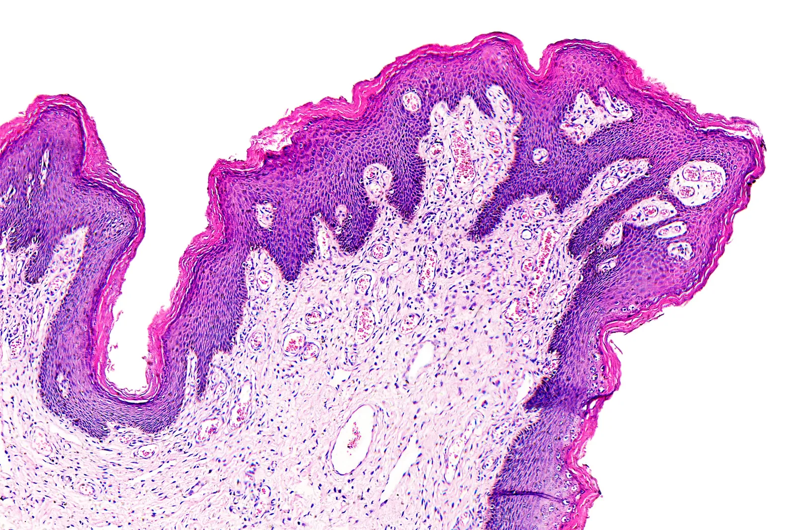 Pathology News Roundup: August 31, 2022